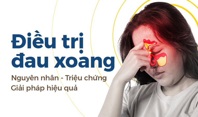 Điều trị đau xoang: Nguyên nhân – Triệu chứng – Giải pháp hiệu quả