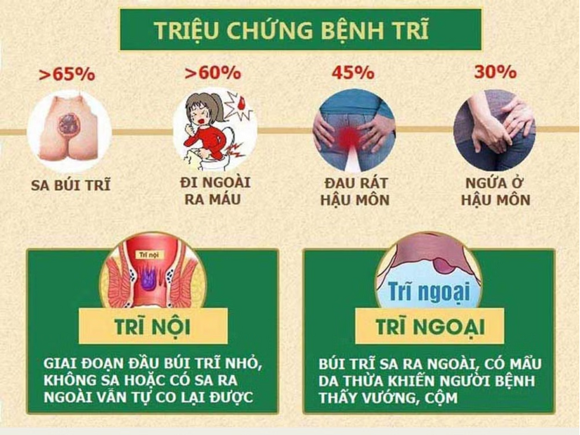 Giải đáp: Bệnh trĩ gây táo bón như thế nào?