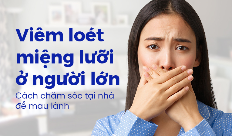 Viêm loét miệng lưỡi ở người lớn: Cách chăm sóc tại nhà để mau lành