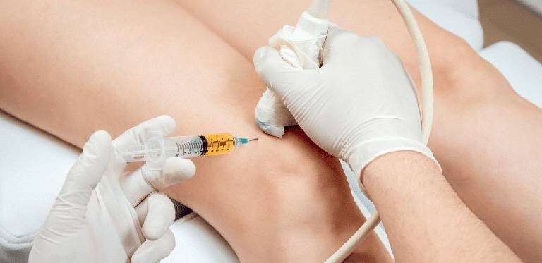 Điều trị viêm đa khớp ngay để tránh biến chứng nguy hiểm