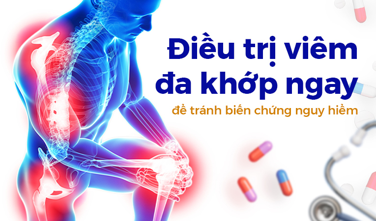 Điều trị viêm đa khớp ngay để tránh biến chứng nguy hiểm