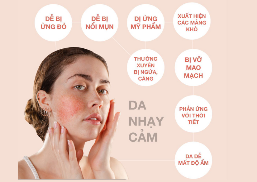 Giải đáp: Da nhạy cảm nên dùng mỹ phẩm nào lành tính, an toàn?