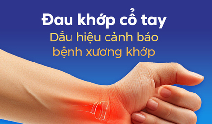 Đau khớp cổ tay: Dấu hiệu cảnh báo bệnh xương khớp