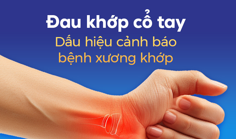 Đau khớp cổ tay: Dấu hiệu cảnh báo bệnh xương khớp