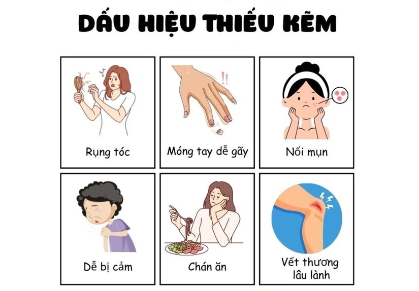 Dấu hiệu thiếu kẽm ở phụ nữ và cách bổ sung hiệu quả