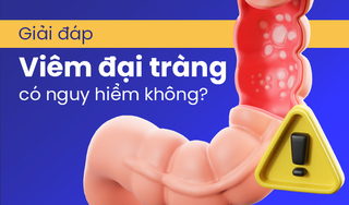 Giải đáp: Viêm đại tràng có nguy hiểm không?