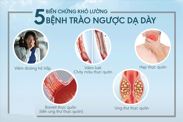 Làm gì khi thường xuyên trào ngược dạ dày ban đêm?