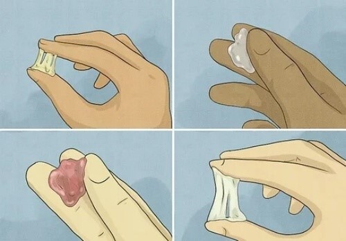 Khí hư bạch đới là gì và làm thế nào để phòng ngừa
