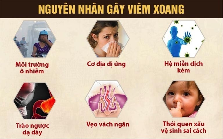 Lưu ý 10 điều mà người mắc bệnh viêm xoang cần tránh