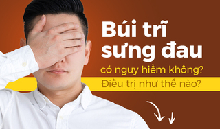 Búi trĩ sưng đau có nguy hiểm không? Điều trị như thế nào?