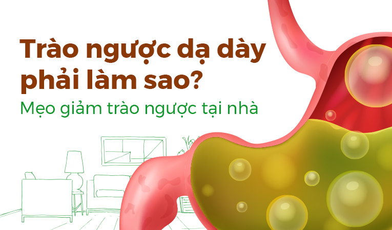 Trào ngược dạ dày phải làm sao? Mẹo giảm trào ngược tại nhà