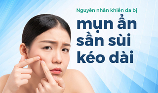 Nguyên nhân khiến da bị mụn ẩn sần sùi kéo dài