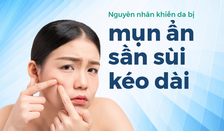 Nguyên nhân khiến da bị mụn ẩn sần sùi kéo dài