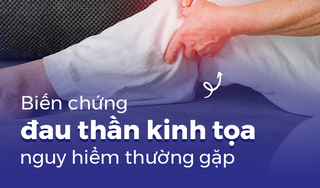 Biến chứng đau thần kinh tọa nguy hiểm thường gặp