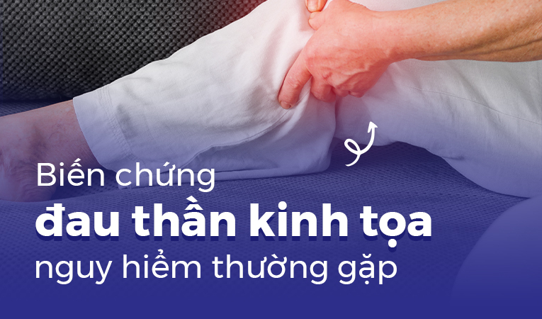 Biến chứng đau thần kinh tọa nguy hiểm thường gặp