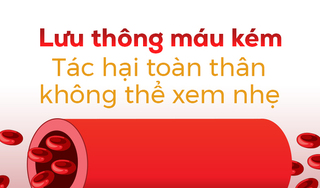 Lưu thông máu kém: Tác hại toàn thân không thể xem nhẹ