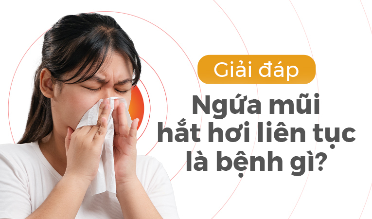 Giải đáp: Ngứa mũi hắt hơi liên tục là bệnh gì?