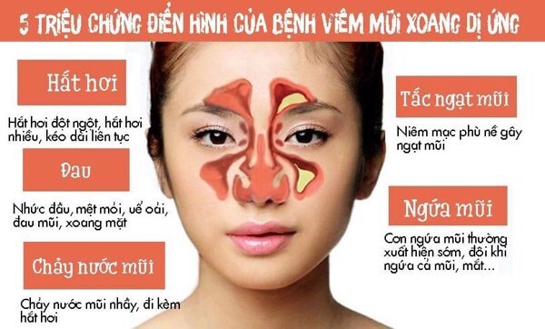 Viêm xoang mũi dị ứng: 10 giải pháp nên áp dụng