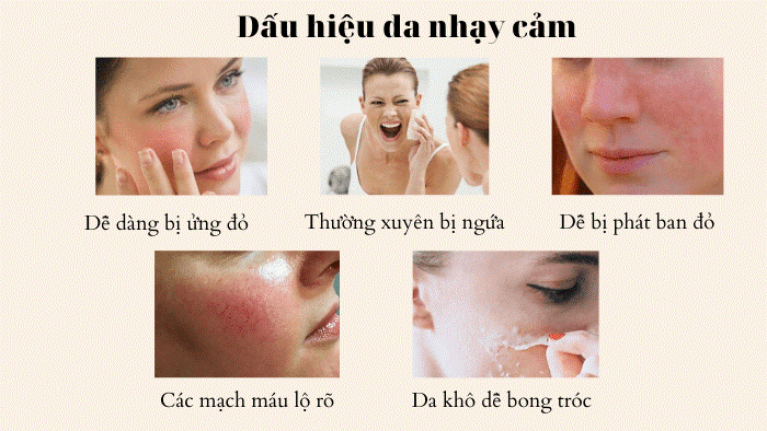 Biểu hiện da nhạy cảm và cách chăm sóc da đúng cách