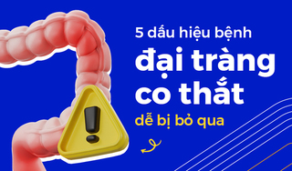 5 dấu hiệu bệnh đại tràng co thắt dễ bị bỏ qua