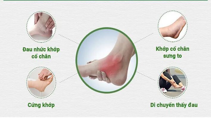 Đau khớp cổ chân là dấu hiệu của bệnh gì?