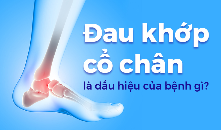 Đau khớp cổ chân là dấu hiệu của bệnh gì?
