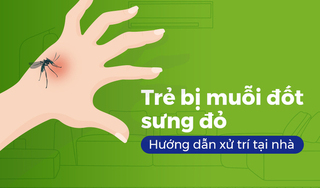 Trẻ bị muỗi đốt sưng đỏ: Hướng dẫn xử trí tại nhà