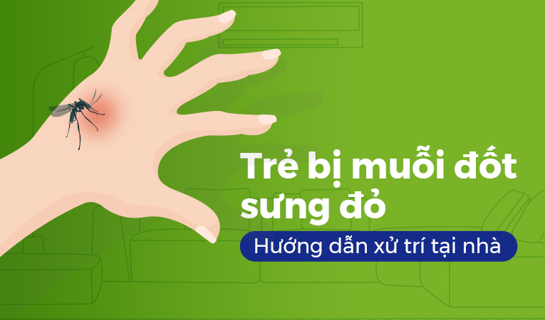 Trẻ bị muỗi đốt sưng đỏ: Hướng dẫn xử trí tại nhà