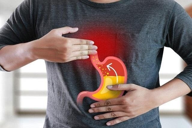Giải đáp thắc mắc: Trào ngược dạ dày kiêng ăn gì?