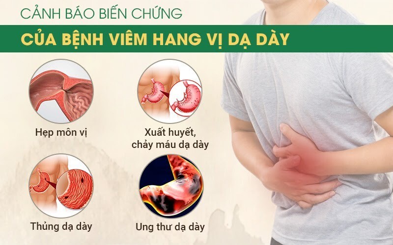 6 dấu hiệu viêm hang vị dạ dày dễ bị bỏ qua