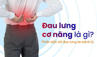 Đau lưng cơ năng là gì? Phân biệt với đau lưng do bệnh lý