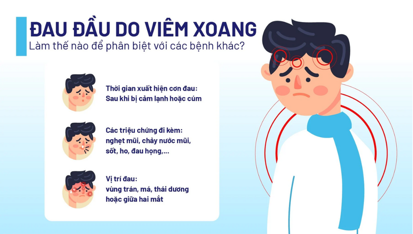 Tham khảo ngay biện pháp giảm các cơn đau đầu do viêm xoang 