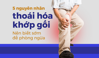 5 nguyên nhân thoái hóa khớp gối: Nên biết sớm để phòng ngừa