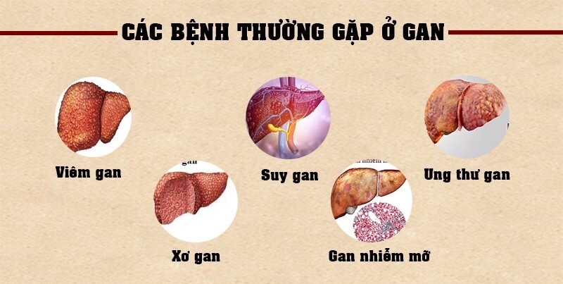 Muốn bảo vệ gan, giải độc gan: Cần bắt đầu từ đâu?