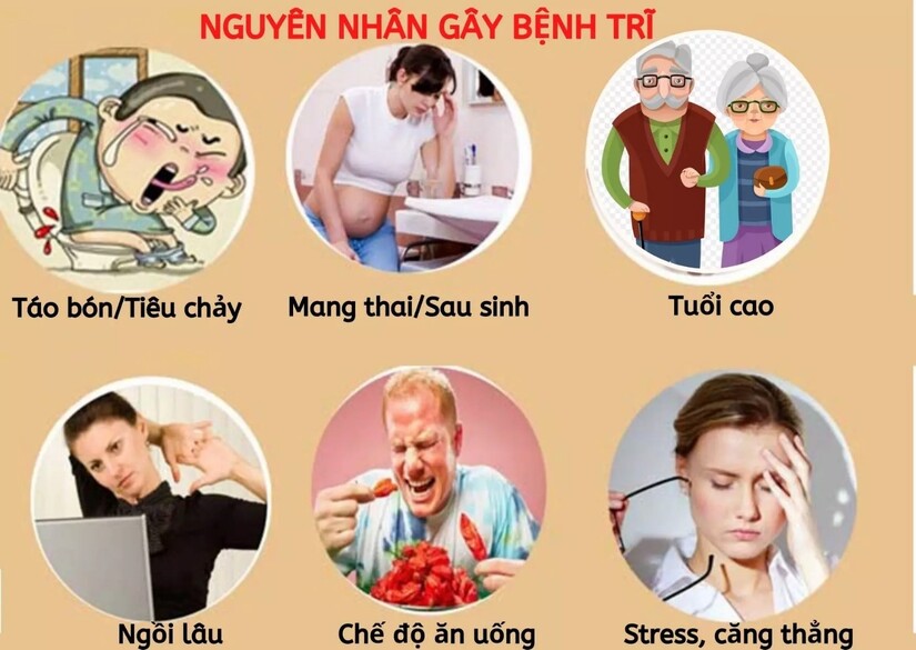 Giải đáp: Bệnh trĩ thường gặp ở độ tuổi nào?