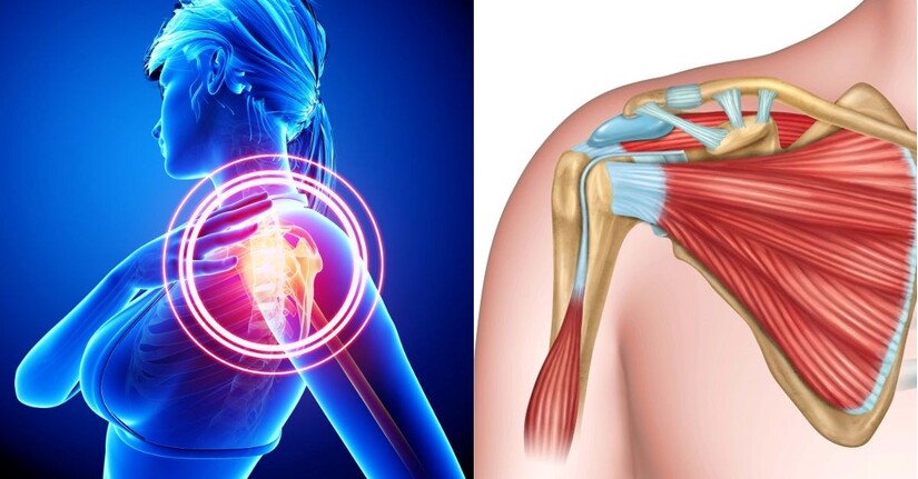 Đau nhức khớp vai do đâu? Giải pháp đơn giản mà hiệu quả