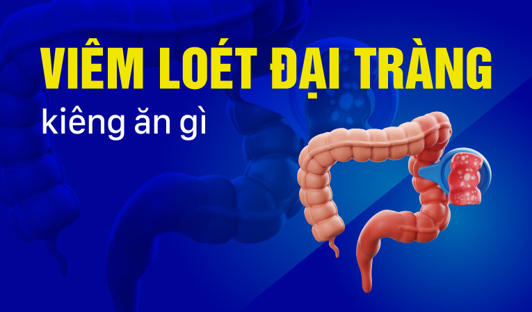 Giải đáp: Viêm loét đại tràng kiêng ăn gì?