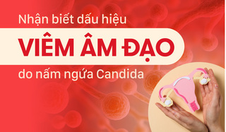 Dấu hiệu nhận biết viêm âm đạo do nấm ngứa Candida