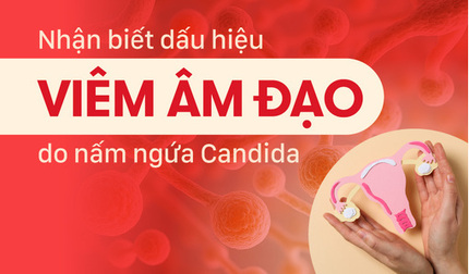 Dấu hiệu nhận biết viêm âm đạo do nấm ngứa Candida