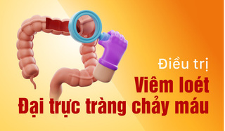 Viêm loét đại trực tràng chảy máu có nguy hiểm không? 