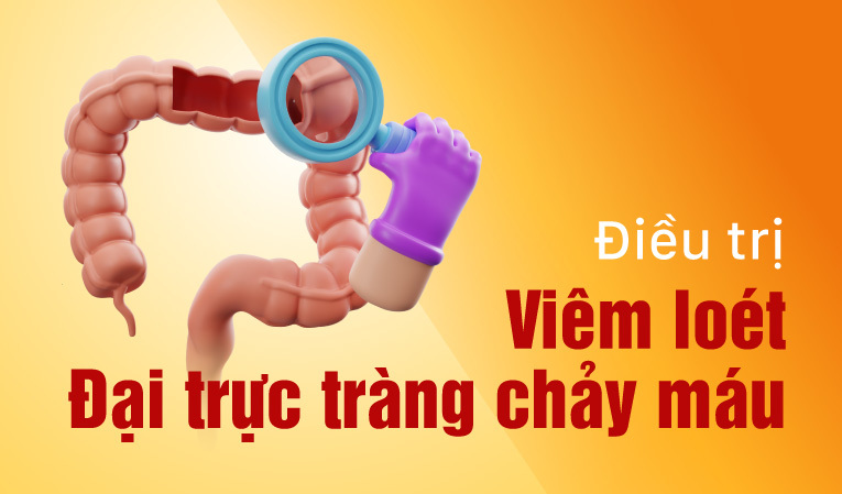 Viêm loét đại trực tràng chảy máu có nguy hiểm không? 