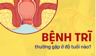Giải đáp: Bệnh trĩ thường gặp ở độ tuổi nào?