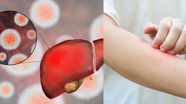 Giải đáp: 6 lý do nên giải độc gan càng sớm càng tốt