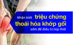 Nhận biết triệu chứng thoái hóa khớp gối sớm để điều trị kịp thời