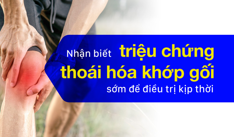 Nhận biết triệu chứng thoái hóa khớp gối sớm để điều trị kịp thời