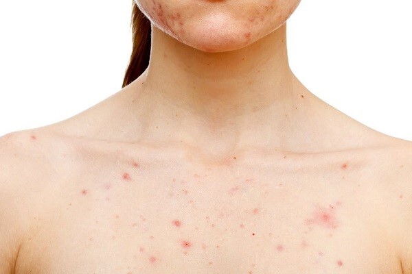 Những dấu hiệu cảnh báo bạn cần giải độc gan ngay