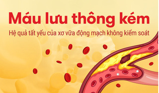 Máu lưu thông kém Hệ quả tất yếu của xơ vữa động mạch không kiểm soát