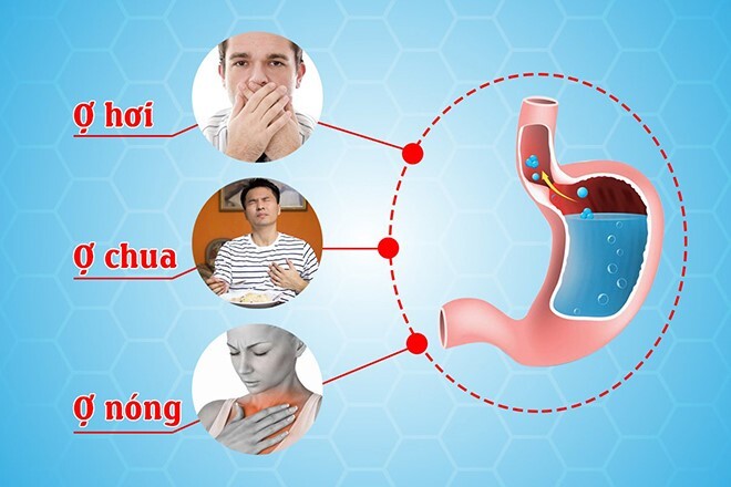 Khi nào cần đi khám bệnh dạ dày? Có nên dùng thảo dược điều trị bệnh?