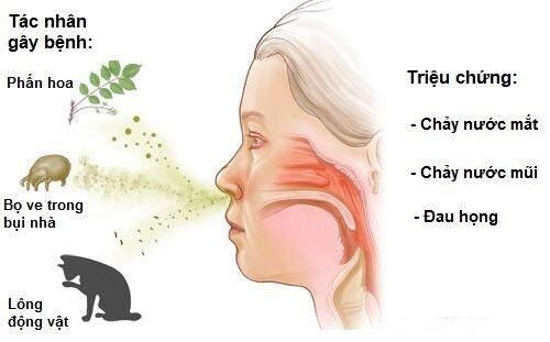 Các cách kiểm soát viêm mũi dị ứng: Không hề khó!