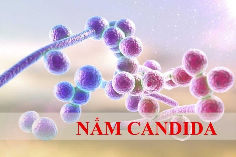 Huyết trắng vón cục như bã đậu: Cảnh báo nhiễm nấm phụ khoa
